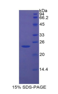 Recombinant Insulin Like Growth Factor Binding Protein 6 (IGFBP6)