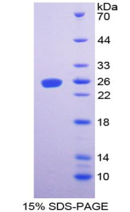 Recombinant Talin 1 (TLN1)