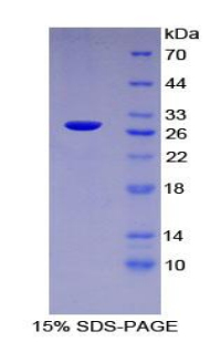 Recombinant Poly ADP Ribose Polymerase (PARP)