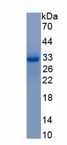 RPA284Hu01.jpg