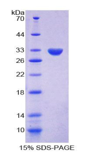 Recombinant Alpha-Fodrin (SPTAN1)