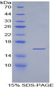 Recombinant Alpha-Fodrin (SPTAN1)