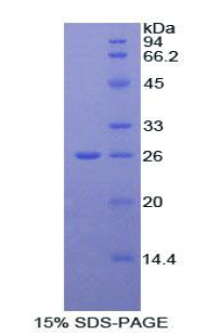 Recombinant Alpha-Fodrin (SPTAN1)