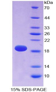 Recombinant Alpha-Fodrin (SPTAN1)