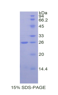 Recombinant Alpha-Fodrin (SPTAN1)