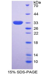 Recombinant Neuronal Pentraxin II (NPTX2)
