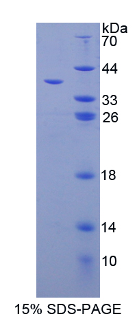 Recombinant Galectin 4 (GAL4)