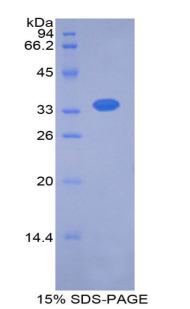 Recombinant Thyroxine Binding Globulin (TBG)