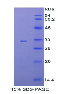 Recombinant Thyroxine Binding Globulin (TBG)