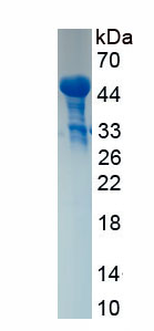 Recombinant Cathepsin L (CTSL)