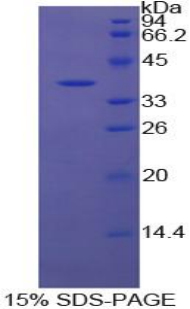 Recombinant Apolipoprotein H (APOH)