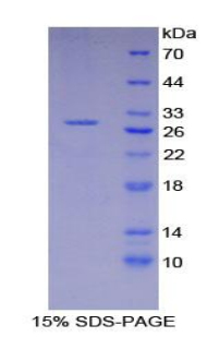 Recombinant X-Ray Repair Cross Complementing 6 (XRCC6)