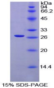 Recombinant X-Ray Repair Cross Complementing 6 (XRCC6)