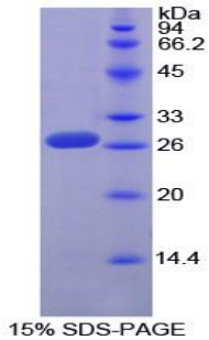 Recombinant Sp100 Nuclear Antigen (Sp100)