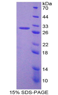 Recombinant Neutrophil Cytosolic Factor 4 (NCF4)