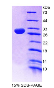 RPA333Hu01.jpg