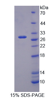 Recombinant Nitric Oxide Synthase 1 Adaptor Protein (NOS1AP)