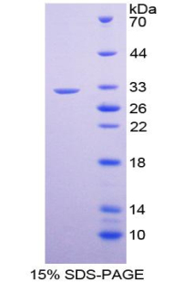 Recombinant GATA Binding Protein 1 (GATA1)
