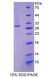 Recombinant Centromere Protein F (CENPF)