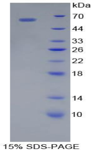 Recombinant Cathepsin A (CTSA)