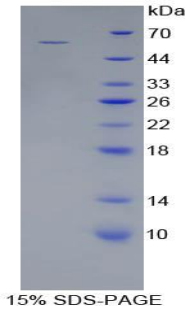 Recombinant Cathepsin A (CTSA)