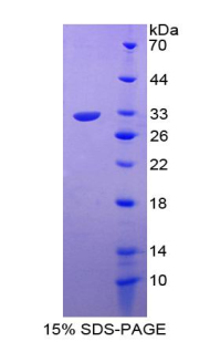 RPA357Hu01.jpg