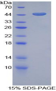 Recombinant Gelsolin (GSN)