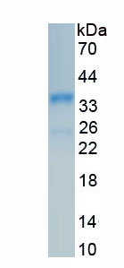 Recombinant Actinin Alpha 2 (ACTN2)