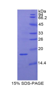 Recombinant Retinol Binding Protein 2, Cellular (RBP2)