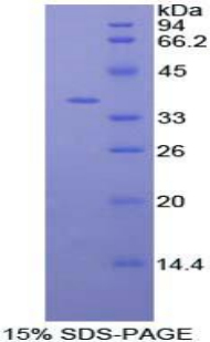 Recombinant Protein Kinase B Gamma (PKBg)