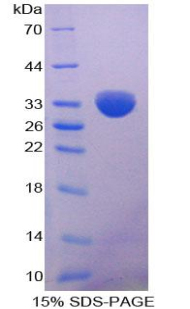 Recombinant Lipoprotein lipase (LPL)