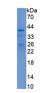 Recombinant Complement Component 3a (C3a)
