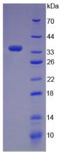 Recombinant Complement Component 5a (C5a)