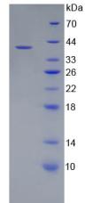 Recombinant Complement Component 5a (C5a)