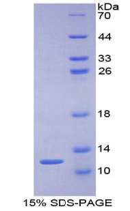 Recombinant Protein Kinase Inhibitor Gamma (PKIg)