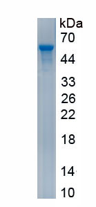 Recombinant Tissue Factor Pathway Inhibitor (TFPI)