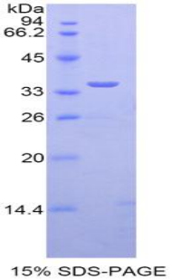 Recombinant Tissue Factor Pathway Inhibitor (TFPI)