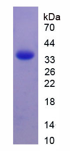 Recombinant Tissue Factor Pathway Inhibitor (TFPI)