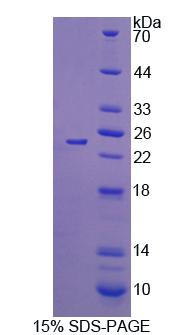 Recombinant Sex Hormone Binding Globulin (SHBG)