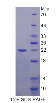 Recombinant Sex Hormone Binding Globulin (SHBG)