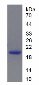 Recombinant Sex Hormone Binding Globulin (SHBG)