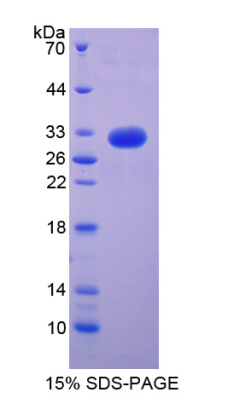 Recombinant Transforming Growth Factor Beta Receptor I (TGFbR1)