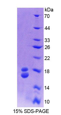 Recombinant Retinol Binding Protein 1, Cellular (RBP1)