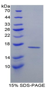 Recombinant Retinol Binding Protein 1, Cellular (RBP1)