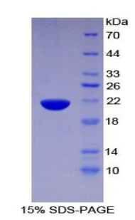Recombinant Pleckstrin Homology Like Domain Family A, Member 2 (PHLDA2)