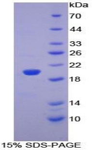 Recombinant Pleckstrin Homology Like Domain Family A, Member 2 (PHLDA2)