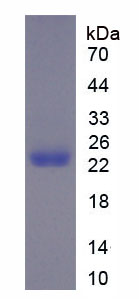 Recombinant Matrix Metalloproteinase 12 (MMP12)