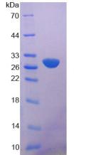 Recombinant Phospholipase A2, Calcium Independent (iPLA2)