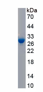 Recombinant Phospholipase A2, Calcium Independent (iPLA2)