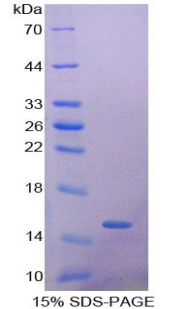 Recombinant Alpha-Hemoglobin Stabilizing Protein (aHSP)